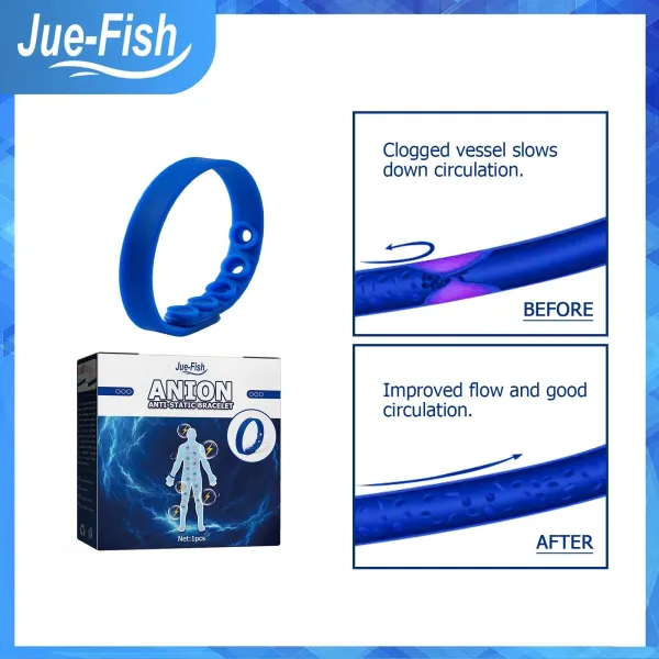 Jue Fish Anti-Static Spray - Bracelet Eliminate Body Static Improve Sleep